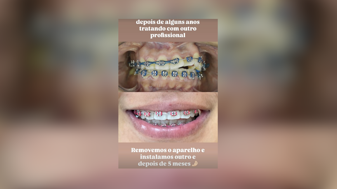 Ortodontia — Dra. Amanda Ramos