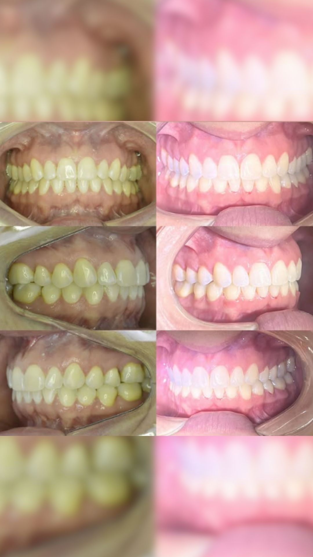 Estética Oral — AR Odontologia